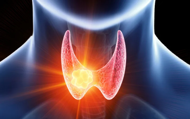 Throat cancer treatment in Varanasi